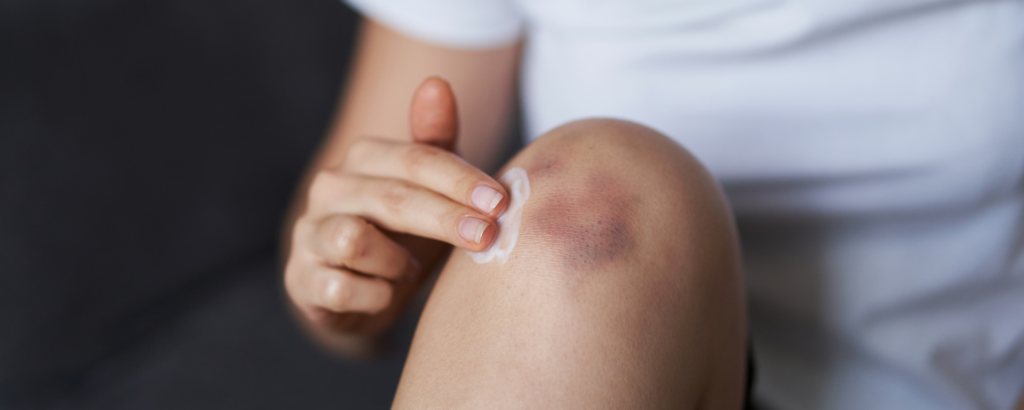 When Are Hematomas Dangerous?